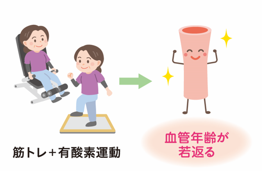 筋トレ+有酸素運動で動脈硬化を防ぐ 悪玉コレステロール値が高い状態を放置しておくと、動脈硬化が進み、脳卒中や心筋梗塞を引き 起こすことも!