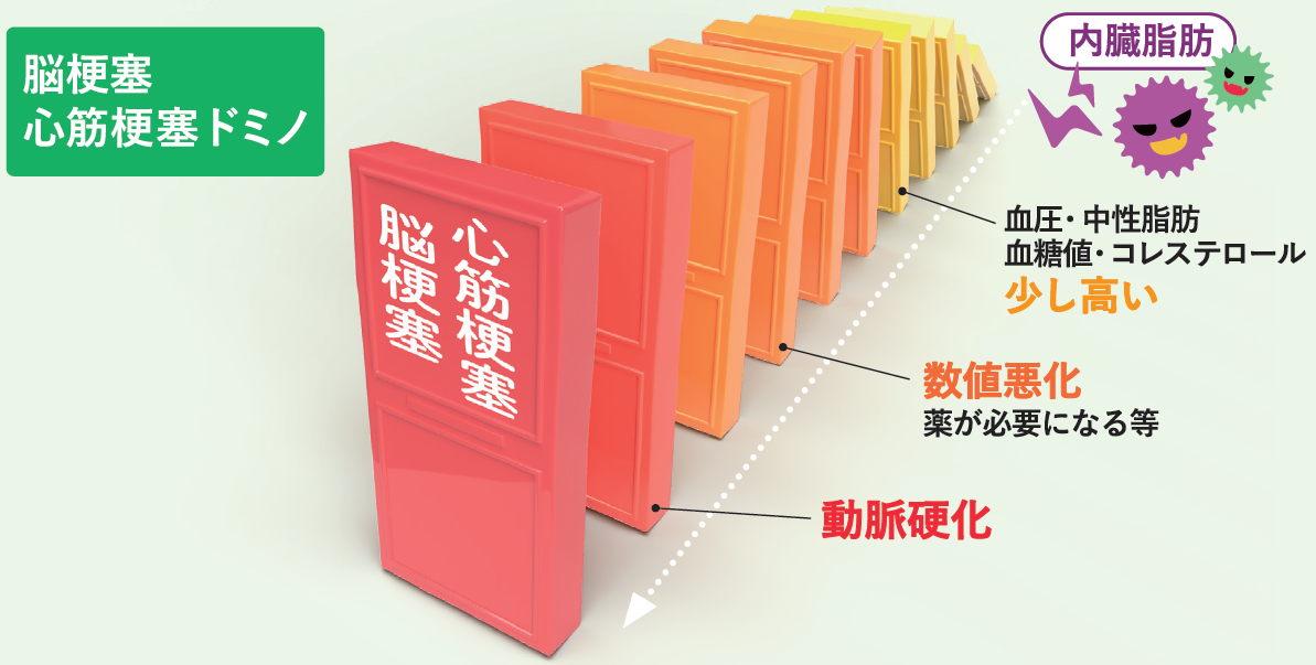 脳梗塞・心筋梗塞を引き起こすメカニズム（高血圧・高コレステロール（脂質異常）・高血糖、その原因はつまり内臓脂肪です。それらは、血管を細く硬く、詰まらせやすくし、心筋梗塞や脳梗塞がいつ起こっても問題ない状態を引き起こします。）